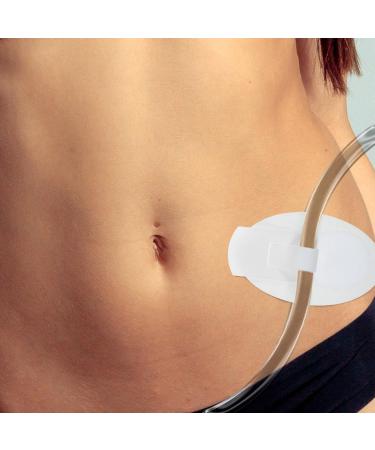 Fomiyes Catheter Sticker - 10 Pack Adhesive Tube Holder for Urine Bag Stabilization & Leg Fastening | Secure Catheter Device - Buy Online on GoSupps.com