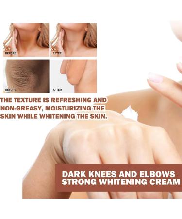 GHEART Joint Darkening Cream Whitening Cream Knuckle Brightening Cream Brightening Cream Body Whitening Cream Skin Brightener Cream Dark Spot Corrector Cream for Remover Light Black Body Skin 1PC - Buy Online on GoSupps.com