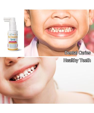 Kids Oral Spray, Toddler Toothpaste Helper for Cavity Prevention and Fresh Breath, Children Anticavity with Fluoride Free for Newborn to Preschoolers, Kid's Mouth Spray 3 - Buy Online on GoSupps.com