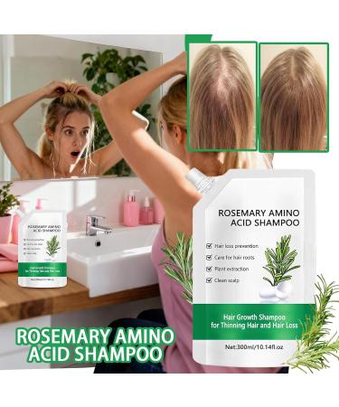 Hair Loss Shampoo for Women Strengthening Plant Shampoo for Thinning Hair Natural Strengthener for Dry Oily Damaged Fine Curly Long Short Sensitive Hair Home Shower Travel - Buy Online on GoSupps.com