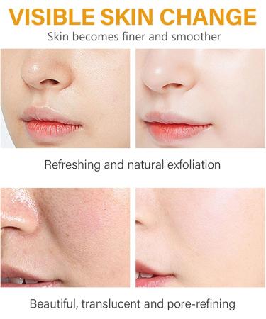  Mnozreo Nourishing Daily Care Serum Turmeric Facial Oil Anti-Spot Face Serum Brightening Serum Kojic Acid Dark Spot Corrector 30ml 1pc - Buy Online on GoSupps.com
