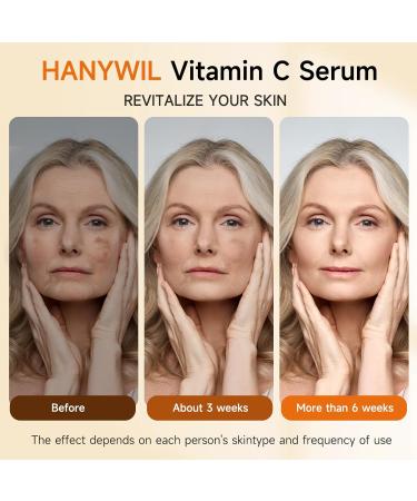 HANYWIL 20% Super Vitamin C Serum for Mature Skin Targets Age Spot & Wrinkle Reduction with Hyaluronic Acid Hydrating Anti-Age Serum 1.7fl oz 1.7 Fl Oz (Pack of 1) - Buy Online on GoSupps.com