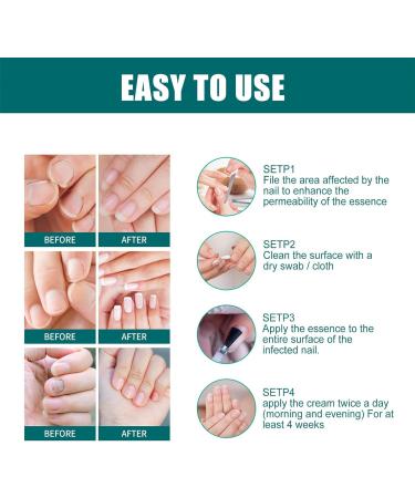 Extra Strong Fungal Nail Serum for Toe and Finger - Repair, Renew, Strengthen Nails - Buy Online on GoSupps.com