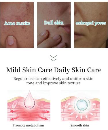 Glycolic Acid 7% Toning Solution 250ml Exfoliating Glycolic Acid Serum for Acne Prone Skin Natural Glow Essence Toning Solution with Glycolic Acid - Buy Online on GoSupps.com