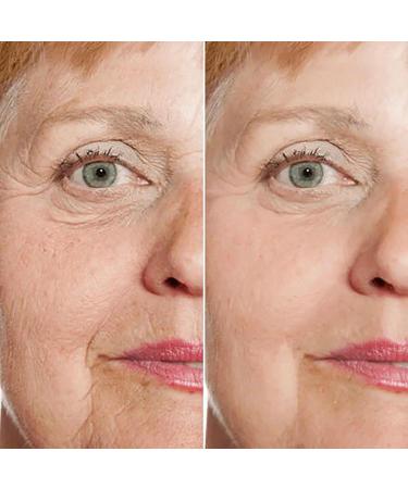 Rejuvenate Face Serum Face Serum Rejuvenate Skin Care Rejuvenate Resurfacing Face Serum Rejuvenation Anti Wrinkle and Remove Dark Spot Deeply Hydration(2pcs) - Buy Online on GoSupps.com