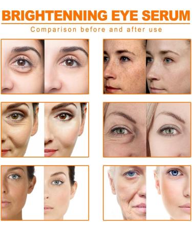 Glycolic Acid 7% Toning Resurfacing Solution Glycolic Acid Toner Hydrating Toning Solution Skincare Exfoliate Toning Solution Glycolic Acid Peel Glycolic Acid 7% Toning Solution Acne Face Toner - Buy Online on GoSupps.com