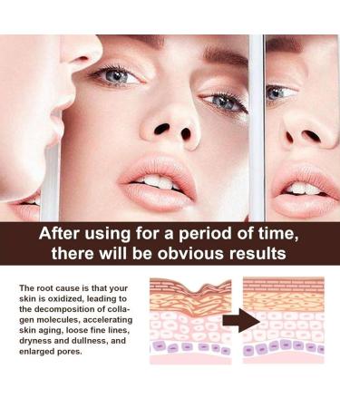 Buy Retinol Cream for Face - Anti-Aging Moisturizer with Hyaluronic Acid | Nourishing Anti-Wrinkle Repair Cream for All Skin Types - 1.05 Oz - Buy Online on GoSupps.com