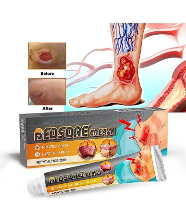 KXC Decubitus Treatment Cream 20g - Relief for Pressure Sores (4 pcs) - Buy Online on GoSupps.com