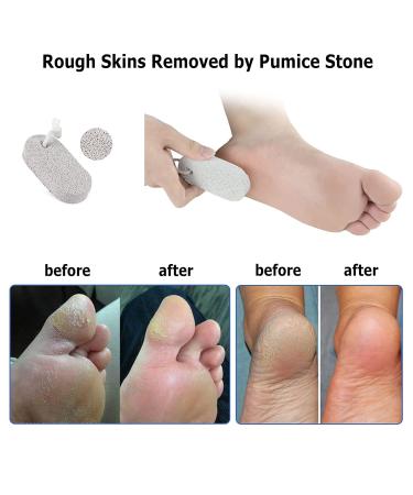 Moisturizing Gel Socks for Dry Cracked Feet | KVMDAZ Soft Spa Socks - International Shipping Available - Buy Online on GoSupps.com