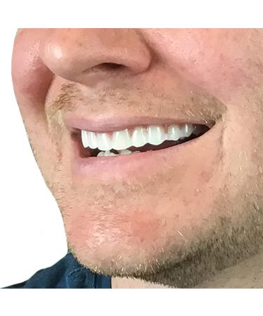 Turcyy Comfort Fit Elastic False Teeth Set - Natural Shade for Confidence - White, 10g, 2 Count - Buy Online on GoSupps.com