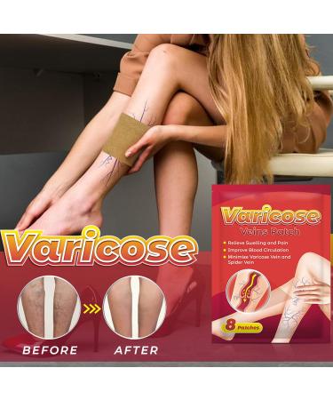 40 Sheets Varicose Veins Treatment Patches | Herbal Extract Spider Vein Removal | Improve Blood Circulation | Portable Solution - Buy Online on GoSupps.com