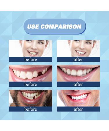 RENYWOSI Provisional Denture Kit | Temporary Restoration for Missing & Broken Teeth | International Shipping Available - Buy Online on GoSupps.com