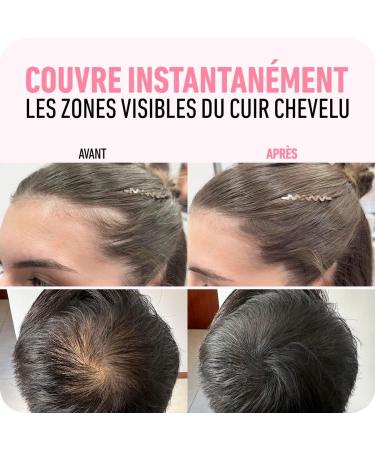 Namika Poudre CheveuxPoudre Cheveux Waterproof Couverture de Racine pour Combler les Clairsem s Pour paissir Poids l ger Taille Compacte Facile Transporter Pour Homme Femme (#9 Brun noisette) - Buy Online on GoSupps.com
