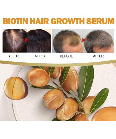 Tongyend Castir Oil Hair Growth Oil Castir Essential Oil Ginger Oil for Hair Growth Rosemary Hair Growth Oil Improve Hair Loss & Nourishes for Women Men-50ML - Buy Online on GoSupps.com