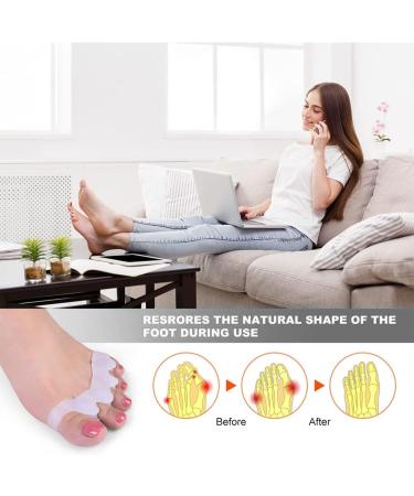 WACURRENTHYD Toe Spacers - Gel Toe Separators for Bunions - Toe Corrector for Men and Women - Hammer Toe Straightener - Big Toe Stretcher - 1 Pair (White) - Buy Online on GoSupps.com