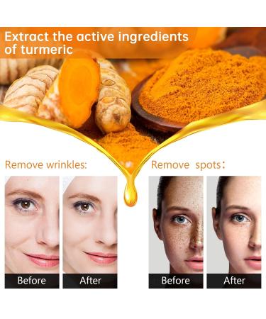 Turmeric Dark Spot Corrector Serum for Acne, Hyperpigmentation, Smooth Skin - 2PCS(60ml) - 1 Fl Oz - Buy Online on GoSupps.com