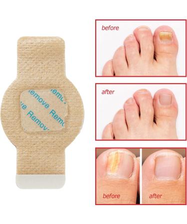 Fungal Nail Patches 21 Patches Multi-Purpose Toenail Repair Treatment Pads- Nail Repair for Damaged Nails 8-Hour Nail Treatment Restores Healthy Appearance (pads) - Buy Online on GoSupps.com