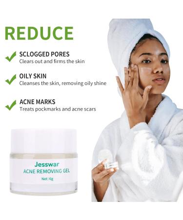 Jesswar Acne Treatment Face Cream - Cystic Acne Spot Treatment for All Skin Types (0.21 Oz) | Fast International Shipping - Buy Online on GoSupps.com