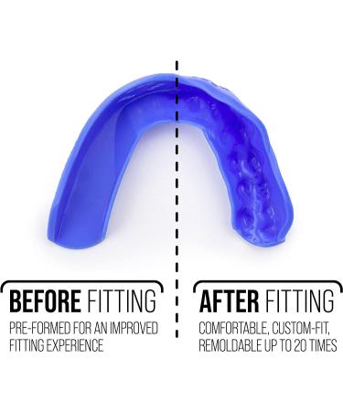 Sports Mouth Guard by SISU 3D 2.0mm Easy-to-Fit  Custom Fit Mouth Guard for Football  Hockey  Lacrosse  Basketball for Youth/Adults Hot Pink - Buy Online on GoSupps.com