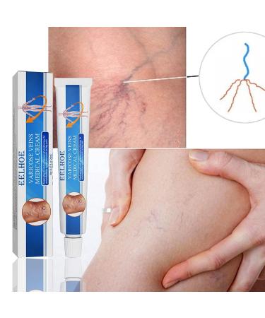 Veinhealth Blue Light Therapy Set for Varicose Veins - Effective Treatment Cream for Legs - Buy Online on GoSupps.com