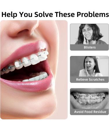 Buy Orthodontic Wax for Braces - 10 Pre-Cut Flavors | Dental Wax for Comfort & Relief - Buy Online on GoSupps.com