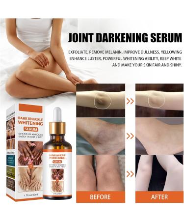 50g Dark Knees and Elbows Lightening Serum Dark Spots Cream Body Whitening Serum Dark Knuckles Whitening Serum Strong Whitening Serum Removing Dark Knuckle Finger Elbow and Knee - Buy Online on GoSupps.com