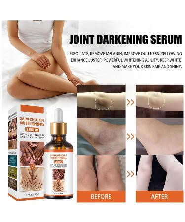 Dark Knuckle Whitening Serum 1.7 Fl Oz - Repair Melanin, Lighten Skin & Remove Darkening - Body Bleaching for Knuckle Elbows - Buy Online on GoSupps.com