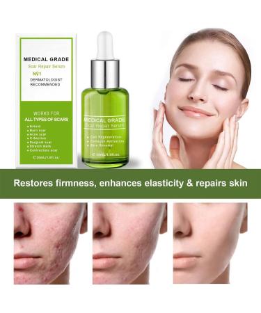 Goopgen Advanced Scar Repair Serum - Effective Treatment for Surgical Scars, Stretch Marks, Acne, Burns - Smooth & Repair Skin - 3PC Set - Buy Online on GoSupps.com
