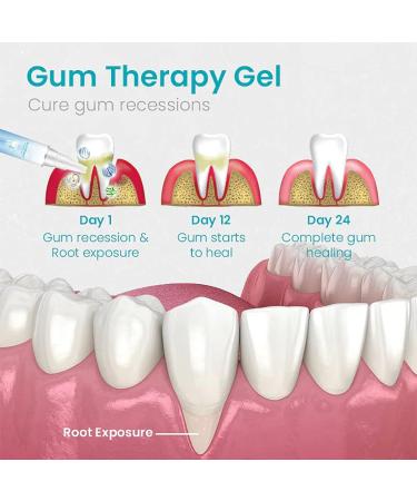 Taileden Gum Therapy Gel Taileden Gum Therapy Gel for Recessed Gums Taileden Gum Care Gel Gum Shield Therapy Gel Gum Therapy Gel Teeth Whitening Essence Pen (2PCS) - Buy Online on GoSupps.com