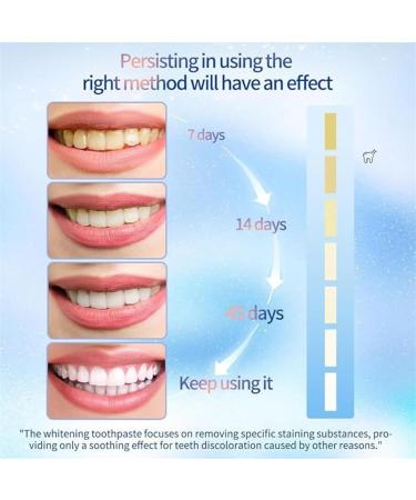 You Toothpaste You Whitening Toothpaste Niacinamide Whitening Toothpaste Whitening Toothpaste Fresh Breath Toothpaste Complete Care Toothpaste (3pcs) - Buy Online on GoSupps.com