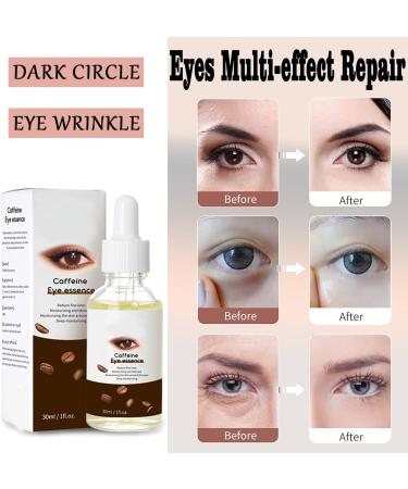 Caffeine Eye Serum Eye Serum for Puffy Eyes Eye Cream for Dark Circles and Puffy Eyes Eye Puffiness Reducer with Vitamin C Under Eye Firming Serum Anti Aging&Deep Hydration Eye Bags Remover Men&Women - Buy Online on GoSupps.com