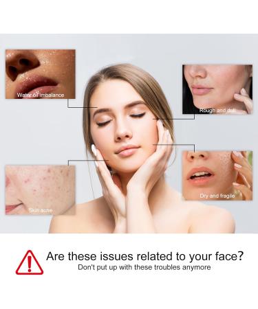  Luthasolic Akne Clean Foam Cleanser 170 g Acne Foaming Wash Akne Gentle Facial Cleansing Foam Deep Pore Cleansing Foam for Facial Cleansing Against Makeup Dirt (4%) - Buy Online on GoSupps.com