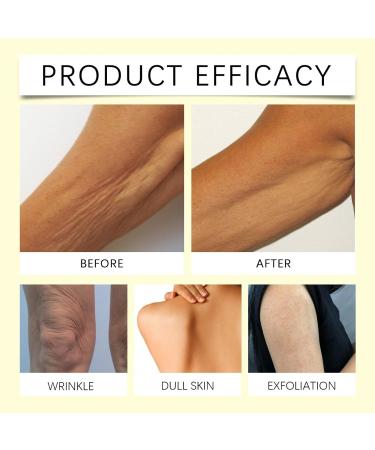 LuxeLift Skin Firming Youth Butter Firming Body Cream Luxelift Skin Firming Cream Butter Anti Aging Moisturizer Luxelift Skin Firming Body Butter for Loose Skin (2) - Buy Online on GoSupps.com
