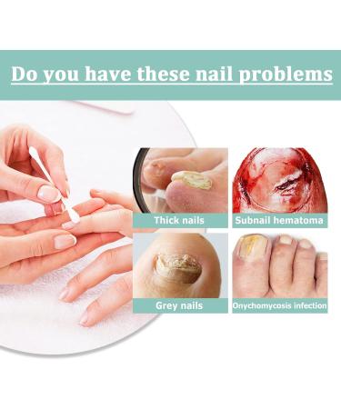 Nail care pen with tea tree oil aloe vera and vitamin E repair and care for fingernails and toenails promotes healthy nail growth nail care pen against brittle and discolored nails - Buy Online on GoSupps.com