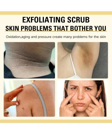 Turmeric Body Scrub Turmeric Scrub with Vitamin C Natural Face Exfoliator Scrub Exfoliating Body Scrub With Turmeric Turmeric Body Scrub For Neck Armpit Back Skin Care Scrub 150G/5.29OZ - Buy Online on GoSupps.com