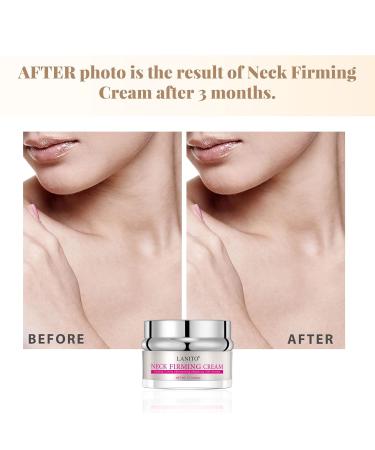Advanced Neck Firming Cream - Anti-Aging Wrinkle-Smoothing Treatment for Women's Neck - Buy Online on GoSupps.com