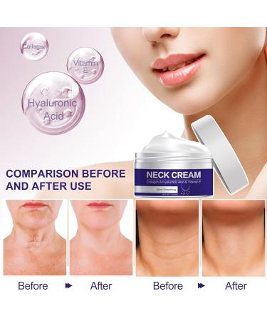 Tighten & Lift Firming Neck Cream - Go Pure Neck Cream for Youthful Skin - Buy Online on GoSupps.com