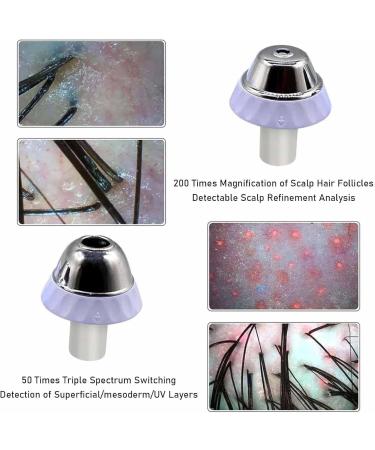 Hair Analyzer for Skin Diagnosis Hair Follicle Analyzer: 11 Inch High Resolution Scalp Detector with 10MP Camera 50x+200x Magnification for Oil Testing - Buy Online on GoSupps.com