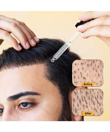5% Minoxidil Hair Growth Serum with Biotin - 1 fl.oz - Men & Women Hair Regrowth Treatment - Buy Online on GoSupps.com