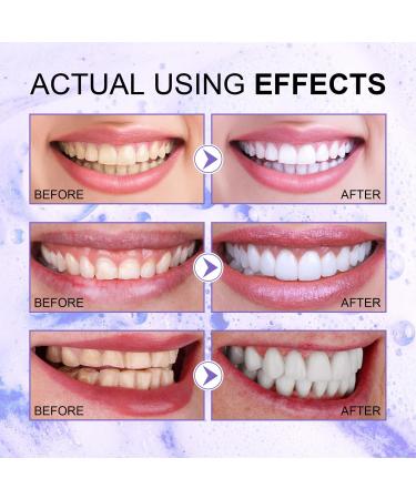 Lila Toothpaste for White Teeth - Purple Tooth Whitening Paste 60g (2-Pack) | Fresh Breath & Stain Removal - Buy Online on GoSupps.com