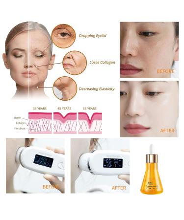 Peptide Anti-Wrinkle Serum 50ml - Quadruple Anti-Aging Effect Hydration & Nourishment for All Skin Types - Buy Online on GoSupps.com