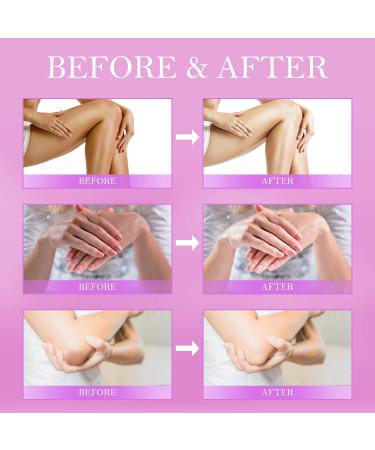 LOVOOD Dark Spot Corrector Cream - Underarm, Neck, Elbow, Private Areas - Instant Results, 2 oz (Upgraded Formula) - Buy Online on GoSupps.com