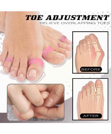 MatureGirl Hammer Toe Straightener 1 Pack Soft Gel Crests Splints - Reduce Foot Pain, Correct Overlap, Flexible Footcare - Sweat-Reducing Foot Cream Included (Pink, One Size) - Buy Online on GoSupps.com