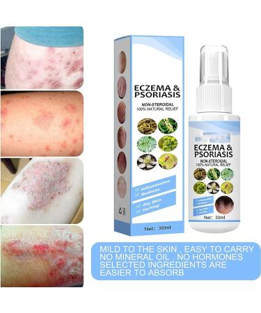 Lymard Meellop Herbal Psoriasis and Eczema Relief Spray - Soothes Itching and Burning (2 Pack) - Buy Online on GoSupps.com