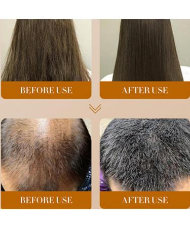 Natural Hair Regrowth - Hair Loss Treatment Volume & Root Booster 30ml Moisturizing Hair Treatment for Stronger Hair Plus Anloximt - Buy Online on GoSupps.com