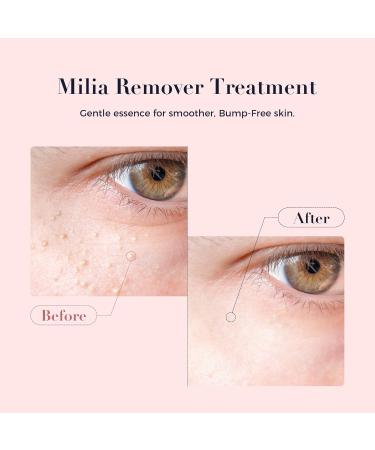 Kisinly Milia Remover for Eye & Face Milia Spot Treatment Serum with Salicylic Acid Milia Acne Cream - Buy Online on GoSupps.com