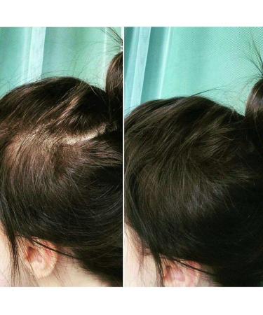 Topaxx Hair Building Fibers - Natural Hair Thickener for Men & Women - Black 0.97oz - Buy Online on GoSupps.com