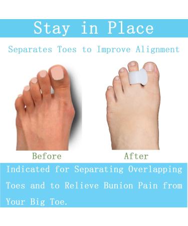 Menocady Pack of 12 Toe Separator Gel Toe Spacers for Bunions - Big Toe Spreaders for Pain Relief and Toe Alignment (White) - Buy Online on GoSupps.com
