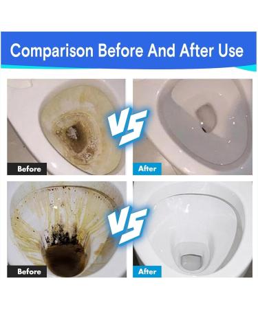 Splash Toilet Cleaner Splash Foam Toilet cleaner splash cleaner Foaming Powder Foam Toilet Cleaner Foaming Powder Powerful Pipe Dredging Agent Easy to Help Solve in Toilet Cleaning (2PC) - Buy Online on GoSupps.com