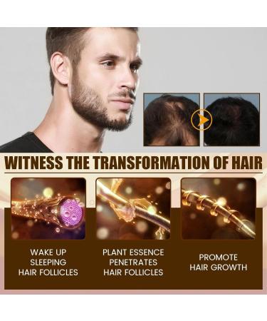 5% Biotin Minoxidil Hair Growth Oil 5% Minoxidil for Men and Women Hair Growth Serum Minoxidil Biotin Hair Growth Serum Nourishes Scalp Stops Hair Loss & Thinning 20ml (20ml) - Buy Online on GoSupps.com